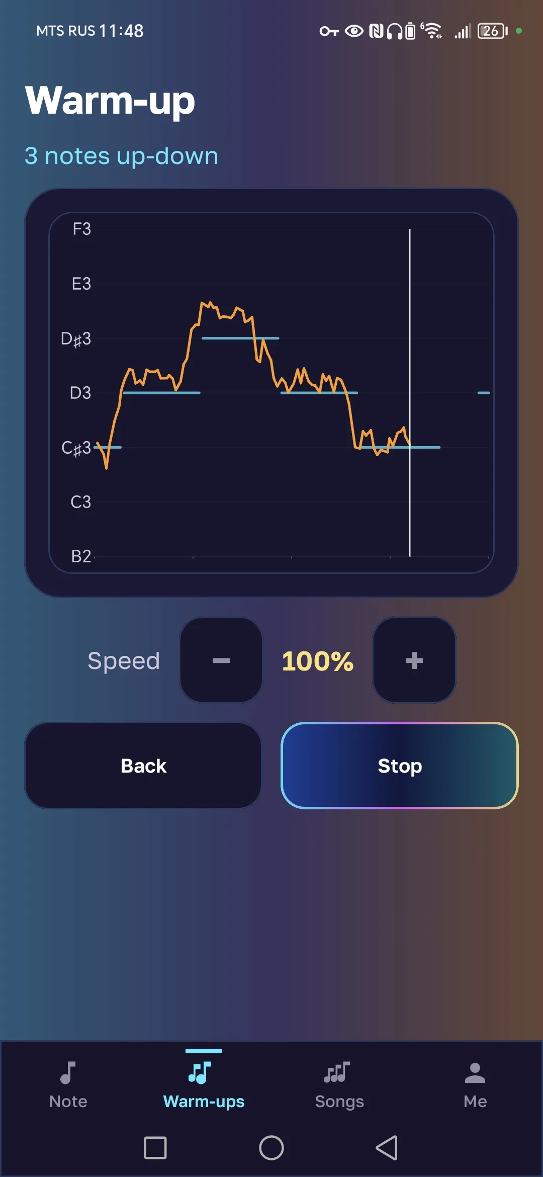 Graphique d’une vocalise dans Doremio